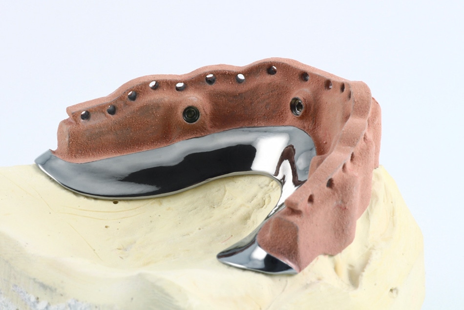 MILLED SUPRASTRUCTURE