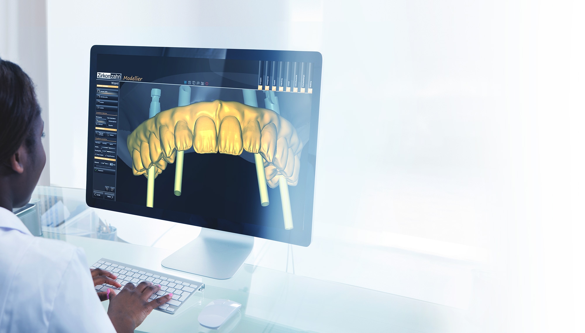 LOGICIEL CAD CAM SPÉCIALISÉ - Laboratoire Dentaire Laval Lafond Desjardins