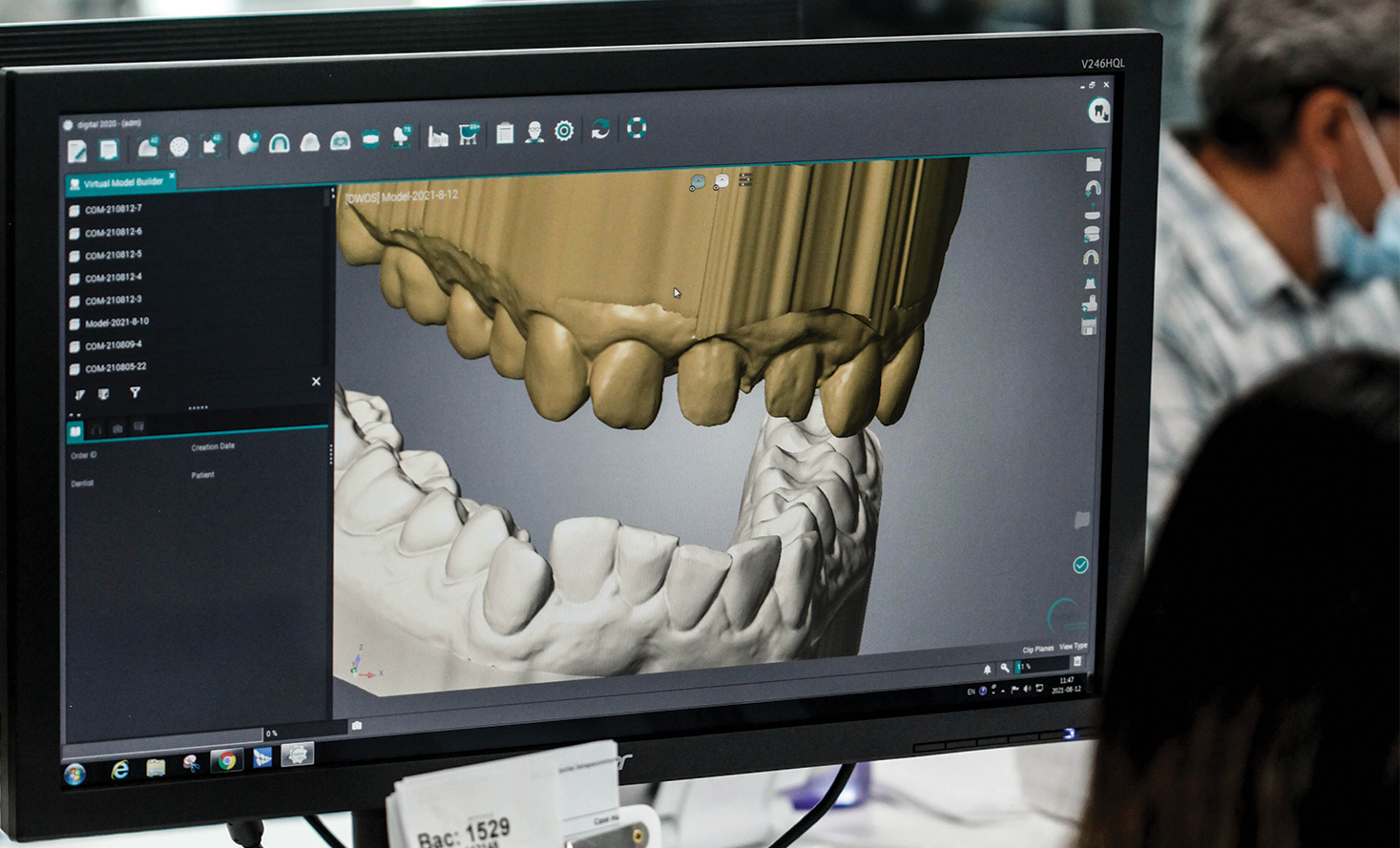 Data transfer on Zirkonzahn PS1 articulator