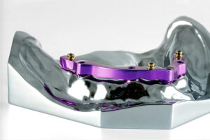 B.IMPLNT_1_FRAISÉE FORME LIBRE - Laboratoire Dentaire Laval Lafond Desjardins