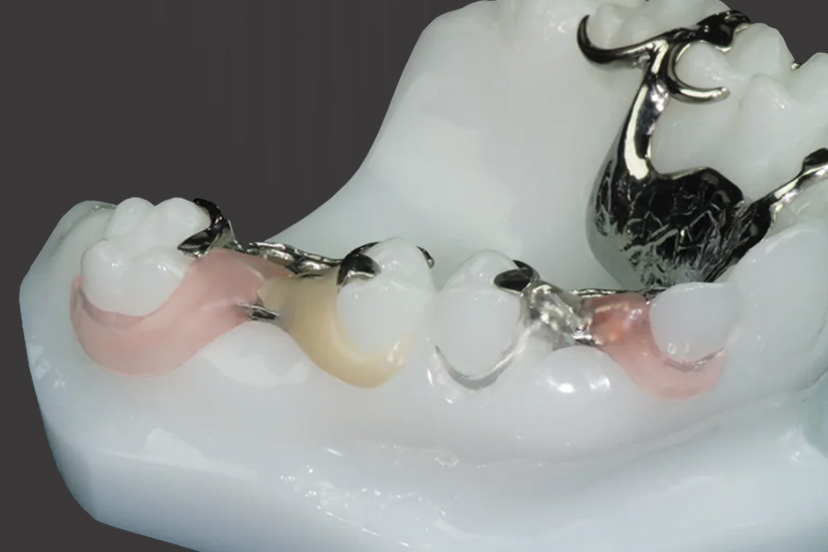 PINK / TRANSPARENT / COLOURED CLASP