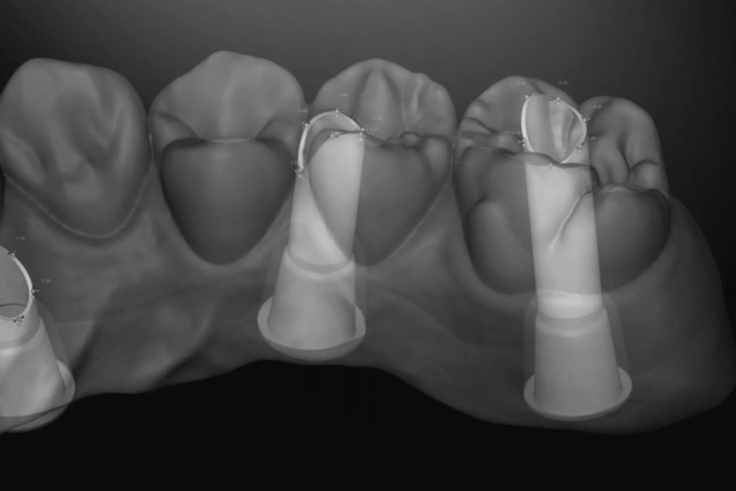 IMPLANTOLOGY SYSTEM